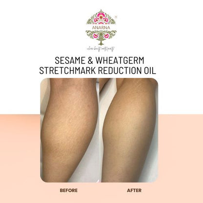 Sesame & Wheatgerm Stretchmark Reduction Oil | Post Partum Care | Reduce Stretchmarks | New Cell Growth